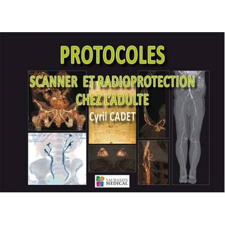 Protocoles, scanner et radioprotection chez l'adulte