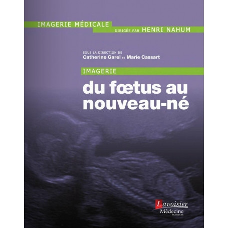 Imagerie du foetus au nouveau-né