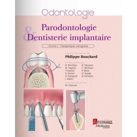 Parodontologie & dentisterie implantaire, tome 2 : thérapeutiques chirurgicales