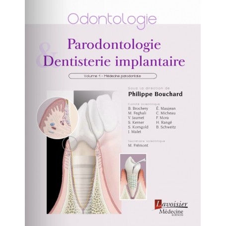 Parodontologie & dentisterie implantaire, tome 1 : médecine parodontale