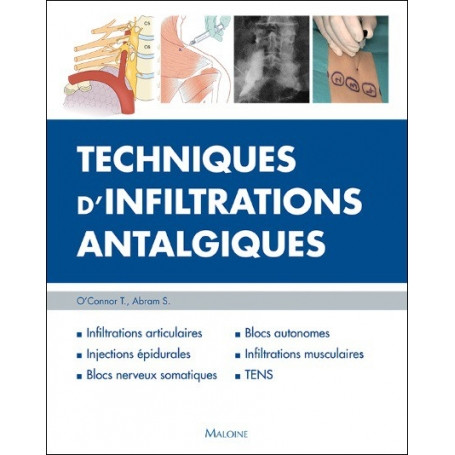 Techniques d'infiltrations antalgiques