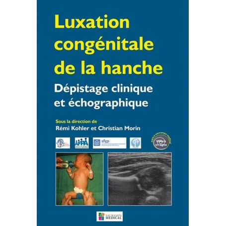 Luxation congénitale de la hanche