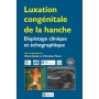 Luxation congénitale de la hanche