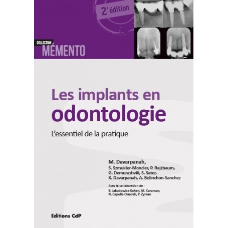 Les implants en odontologie 