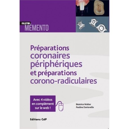 Préparations coronaires périphériques et préparations corono-radiculaires