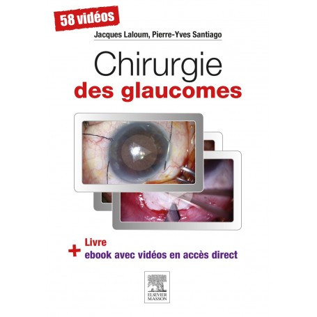 Chirurgie des glaucomes