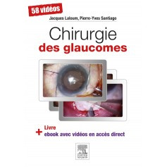 Chirurgie des glaucomes