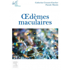 Oedèmes maculaires - Rapport SFO 2016