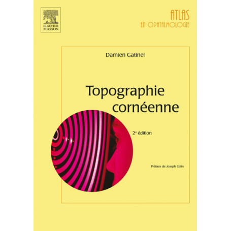 Topographie cornéenne