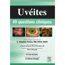 Uvéites : 49 questions...