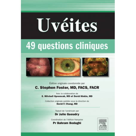 Uvéites : 49 questions cliniques