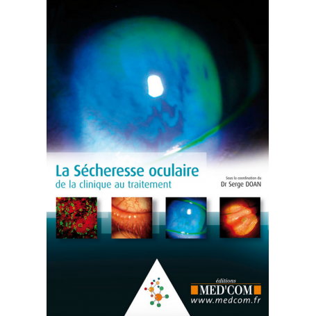 La sécheresse oculaire