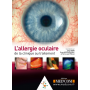 L\'allergie oculaire