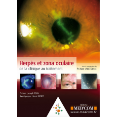 Herpès et zona oculaire