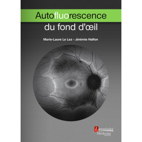 Autofluorescence du fond d'oeil