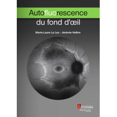 Autofluorescence du fond d'oeil