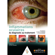 Inflammations oculaires