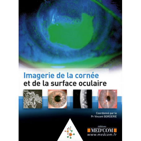 Imagerie de la cornée et de la surface oculaire