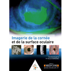 Imagerie de la cornée et de la surface oculaire 