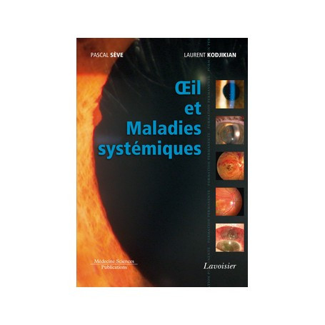 Oeil et maladies systémiques