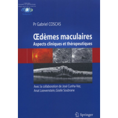 Oedèmes maculaires 