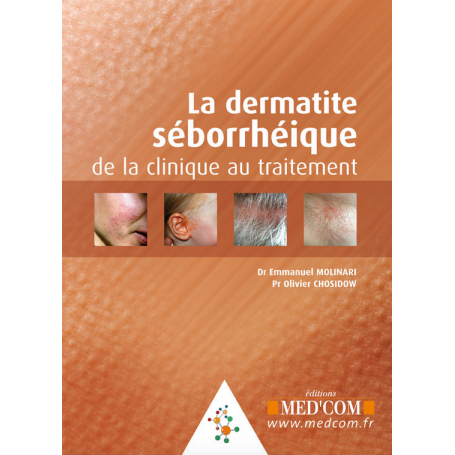 La dermatite séborrhéique