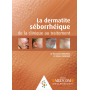 La dermatite séborrhéique