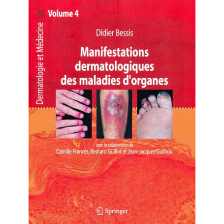 Manifestations dermatologiques des maladies d'organes