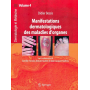 Manifestations dermatologiques des maladies d'organes