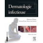 Dermatologie infectieuse