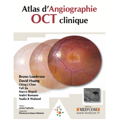Atlas d'angiographie OCT clinique