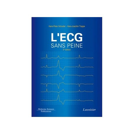 L'ECG sans peine