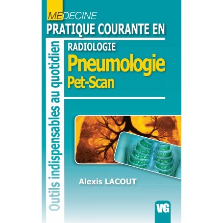 Radiologie, pneumologie, PET-SCAN