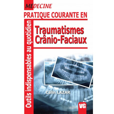 Traumatismes crânio-faciaux