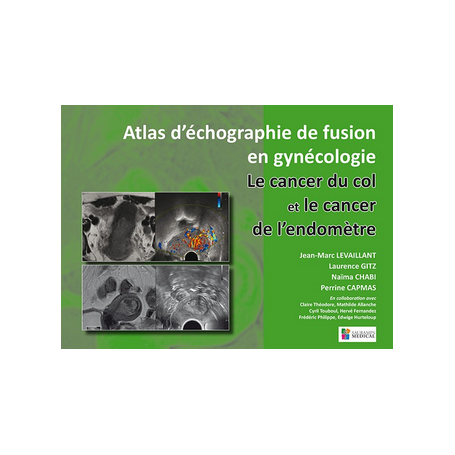 Atlas d'échographie de fusion en gynécologie