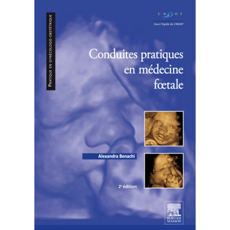 Conduites pratiques en médecine fœtale