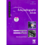 Echocardiographie foetale