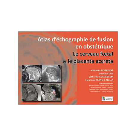 Atlas d'échographie de fusion en obstétrique