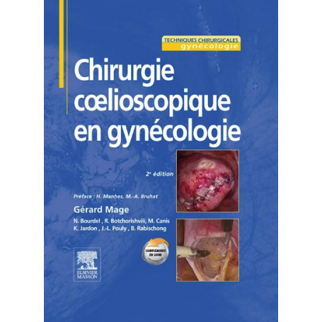 Chirurgie cœlioscopique en gynécologie