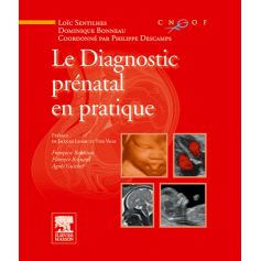 Le diagnostic prénatal en pratique