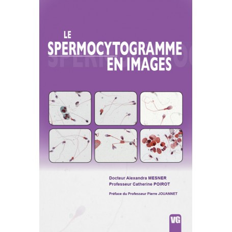 Le spermocytogramme en images