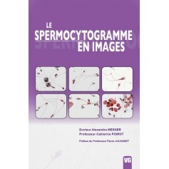 Le spermocytogramme en images