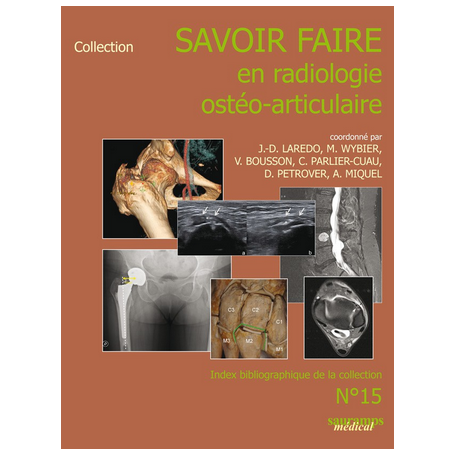 Savoir faire en radiologie ostéo-articulaire n°15