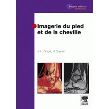 Imagerie du pied et de la...