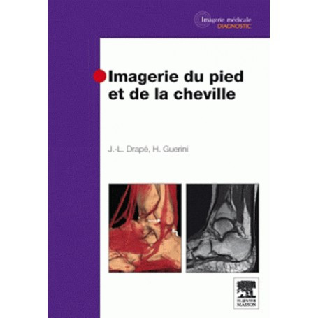 Imagerie du pied et de la cheville