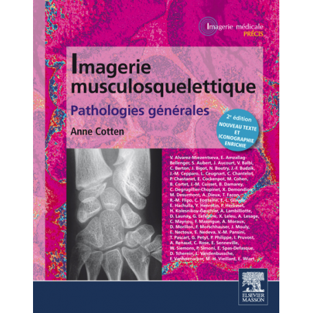 Imagerie musculosquelettique : pathologies générales