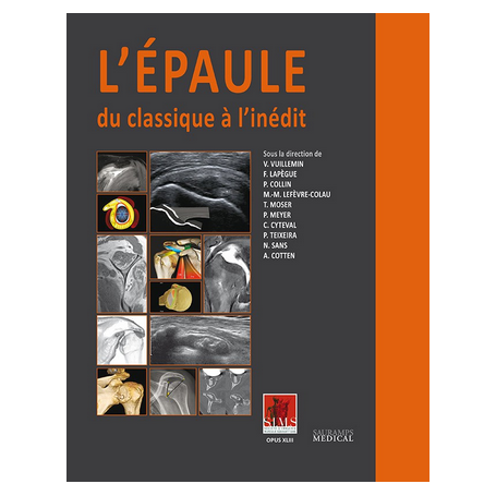 L'épaule : du classique à l'inédit