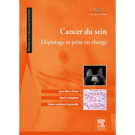 Cancer du sein