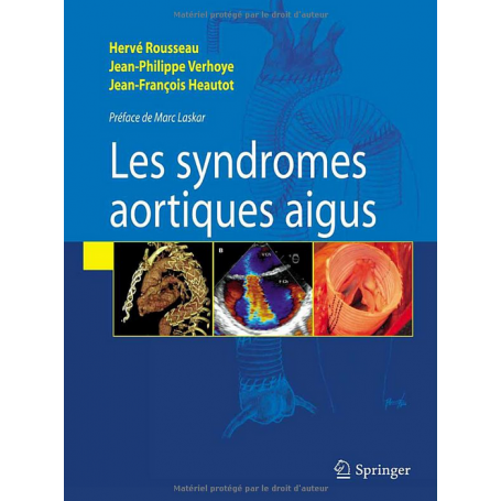 Les syndromes aortiques aigus