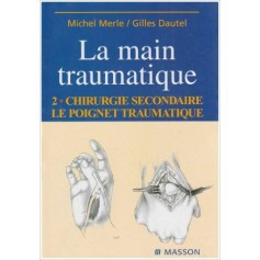 La main traumatique, tome 2 : la main traumatique